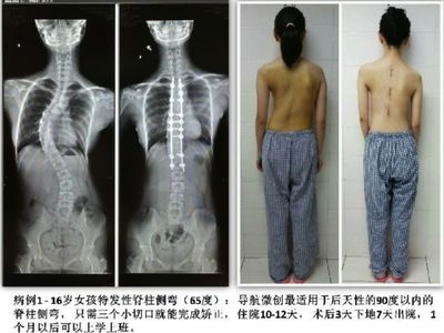 加固效果評(píng)估的實(shí)際案例，加固效果評(píng)估實(shí)際案例 行業(yè)新聞 第4張